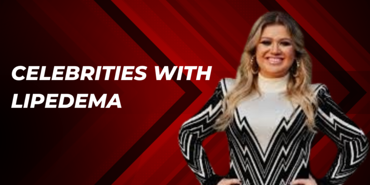 celebrities with lipedema