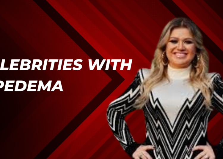 celebrities with lipedema